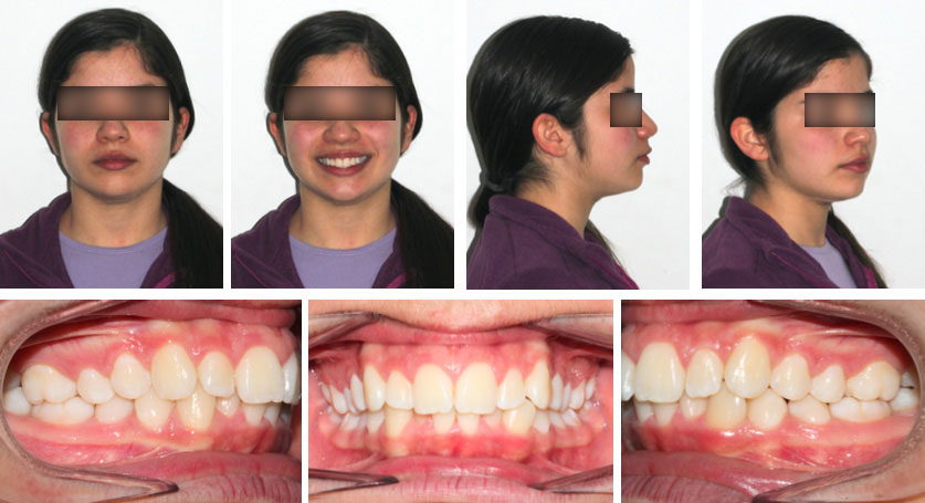 Estudio Ortodoncia - Estudio completo de ortodoncia