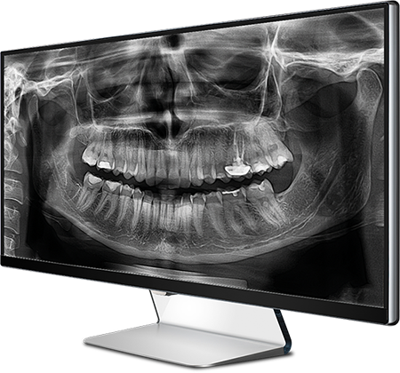 Ortopantomografía digital